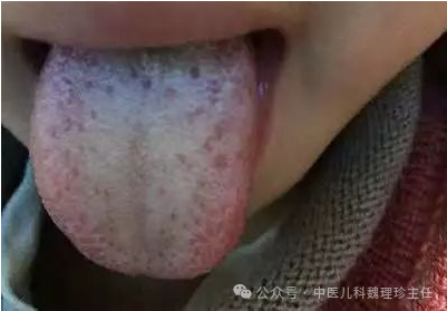 長高的藥材_藥用長高_農村吃長高的草藥