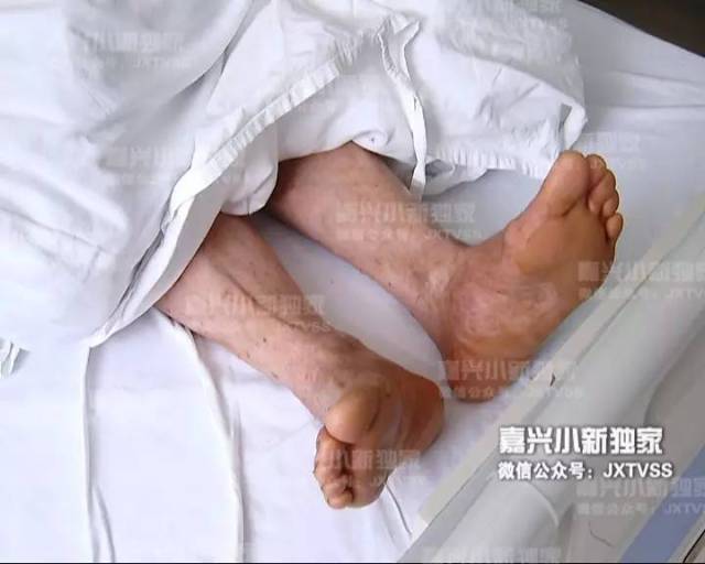 喝農藥的感覺_農藥喝了_喝下農藥的感覺